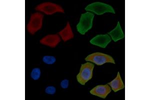 ABIN6263599 and ABIN6277934 staining Hela cells(30 min of UV treatment) by IF/ICC. (Nestin Antikörper  (C-Term))