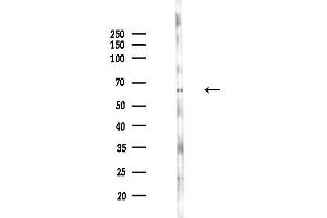anti-BUD13 Homolog (BUD13) antibody