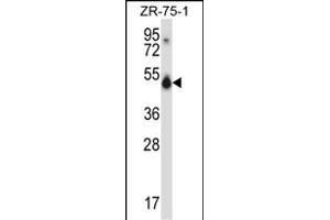 CUGBP1 Antibody (N-term) (ABIN657957 and ABIN2846902) western blot analysis in ZR-75-1 cell line lysates (35 μg/lane). (CELF1 Antikörper  (N-Term))