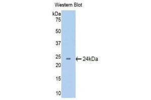 Western Blotting (WB) image for anti-Crystallin, beta B2 (CRYbB2) (AA 17-191) antibody (ABIN1077954) (CRYbB2 Antikörper  (AA 17-191))