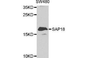 Western blot analysis of extracts of K562 cell line, using SAP18 antibody. (SAP18 Antikörper  (AA 21-172))