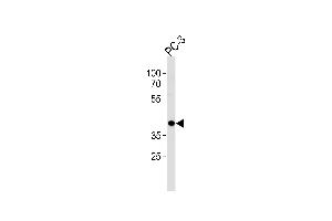 Western Blotting (WB) image for anti-CAMP Responsive Element Binding Protein 3-Like 4 (CREB3L4) (AA 338-366), (C-Term) antibody (ABIN5533679)