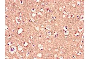 Immunohistochemistry of paraffin-embedded human brain tissue using ABIN7159104 at dilution of 1:100 (MED12 Antikörper  (AA 1742-2011))