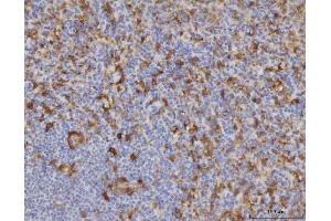 IHC analysis of ME1 using anti-ME1 antibody (ABIN7599485). (ME1 Antikörper  (AA 1-572))
