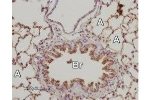 Expression of Adenosine A2B Receptor in rat lung - Immunohistochemical staining of rat lung paraffin embedded sections using Anti-Adenosine A2B Receptor (extracellular) Antibody (ABIN7042889, ABIN7043890 and ABIN7043891), (1:50).