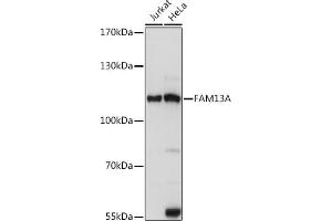 Western blot analysis of extracts of various cell lines, using FA antibody (ABIN7267109) at 1:1000 dilution. (FAM13A Antikörper  (AA 1-200))