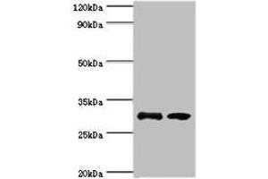 Western blot All lanes: RPA4 antibody at 3 μg/mL Lane 1: K562 whole cell lysate Lane 2: Mouse spleen tissue Secondary Goat polyclonal to rabbit IgG at 1/10000 dilution Predicted band size: 29 kDa Observed band size: 29 kDa