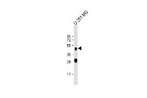 Anti-CTSD Antibody at 1:2000 dilution + U-251 MG whole cell lysate Lysates/proteins at 20 μg per lane.