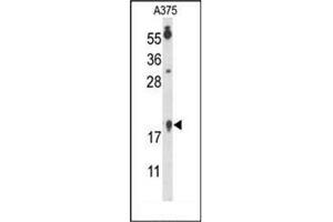Western Blotting (WB) image for anti-Family with Sequence Similarity 96, Member B (FAM96B) (C-Term), (N-Term) antibody (ABIN952260)