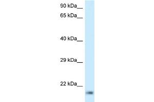 WB Suggested Anti-RPL23A Antibody Titration: 1. (RPL23A Antikörper  (C-Term))