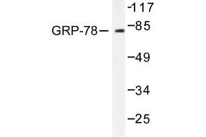 Image no. 1 for anti-Heat Shock 70kDa Protein 5 (Glucose-Regulated Protein, 78kDa) (HSPA5) antibody (ABIN265447) (GRP78 Antikörper)