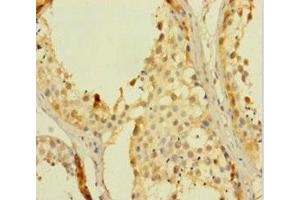Immunohistochemistry of paraffin-embedded human testis tissue using ABIN7168079 at dilution of 1:100 (RHOXF2 Antikörper  (AA 1-244))