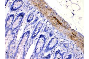 Immunohistochemistry (IHC) image for anti-Cholinergic Receptor, Nicotinic, alpha 5 (Neuronal) (CHRNA5) (AA 44-76), (N-Term) antibody (ABIN5518749)