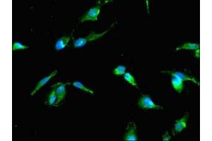 Immunofluorescent analysis of Hela cells using ABIN7173925 at dilution of 1:100 and Alexa Fluor 488-congugated AffiniPure Goat Anti-Rabbit IgG(H+L) (TP53I11 Antikörper  (AA 1-41))