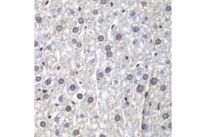 Immunohistochemistry of paraffin-embedded mouse liver using U2AF1 antibody at dilution of 1:200 (400x lens).