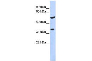 WB Suggested Anti-ZFP36L2 Antibody Titration:  0.