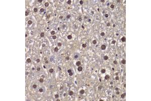 Immunohistochemistry of paraffin-embedded mouse liver using SMARCB1 antibody at dilution of 1:200 (400x lens). (SMARCB1 Antikörper)