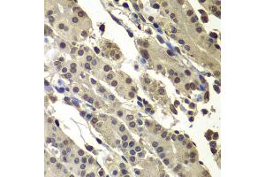 Immunohistochemistry of paraffin-embedded human stomach using SUB1 antibody (ABIN5974252) at dilution of 1/100 (40x lens).