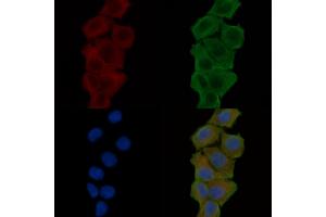 ABIN6257764 and ABIN6275378 staining Hela cells(24h of starvation treatment) by IF/ICC.
