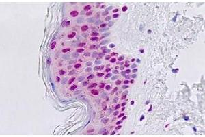 Human, Skin: Formalin-Fixed Paraffin-Embedded (FFPE) (GTF3C3 Antikörper  (AA 101-150))