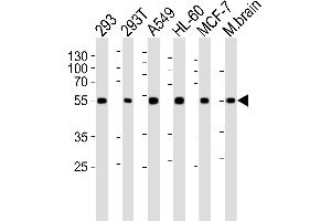 Western blot analysis of lysates from 293, 293T, A549, HL-60, MCF-7 cell line and mouse brain tissue lysate (from left to right), using DKK3 Antibody (A30) at 1:1000 at each lane.