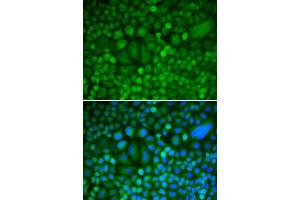Immunofluorescence (IF) image for anti-Cyclin H (CCNH) (AA 1-323) antibody (ABIN3021259) (Cyclin H Antikörper  (AA 1-323))