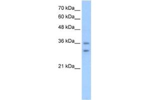 Western Blotting (WB) image for anti-Olfactory Receptor, Family 6, Subfamily C, Member 70 (OR6C70) antibody (ABIN2462825) (OR6C70 Antikörper)