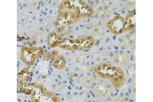 Immunohistochemistry of paraffin-embedded Rat kidney using NAT8 Polyclonal Antibody (NAT8 Antikörper)