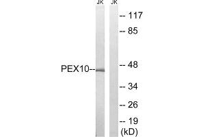 Western blot analysis of extracts from Jurkat cells, using PEX10 antibody. (PEX10 Antikörper  (Internal Region))