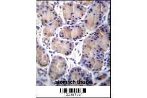 CES8 Antibody immunohistochemistry analysis in formalin fixed and paraffin embedded human stomach tissue followed by peroxidase conjugation of the secondary antibody and DAB staining. (CES4A Antikörper  (C-Term))