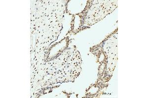 IHC analysis of AKAP 95/AKAP8 using anti-AKAP 95/AKAP8 antibody (ABIN7601553). (AKAP8 Antikörper  (AA 380-546))