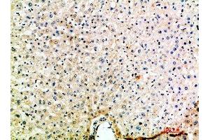 Immunohistochemical analysis of paraffin-embedded human-liver, antibody was diluted at 1:200 (CCL15 Antikörper  (AA 51-100))