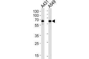 Western Blotting (WB) image for anti-Stress-Induced-phosphoprotein 1 (STIP1) antibody (ABIN3001649) (STIP1 Antikörper)