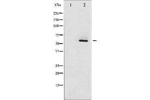 Western blot analysis of Estrogen Receptor- beta phosphorylation expression in HepG2 whole cell lysates,The lane on the left is treated with the antigen-specific peptide. (ESR2 Antikörper  (pSer105))