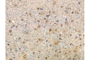 Phospho-Tau (Thr492/Thr175) Antibody at 1/100 staining Rat brain tissue by IHC-P. (MAPT Antikörper  (pThr175, pThr492))