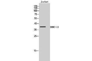 Western Blotting (WB) image for anti-Zinc Finger, DHHC-Type Containing 15 (ZDHHC15) (C-Term) antibody (ABIN3174754) (ZDHHC15 Antikörper  (C-Term))