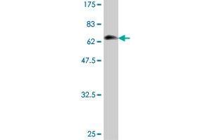 Western Blot detection against Immunogen (69. (NDRG1 Antikörper  (AA 1-394))