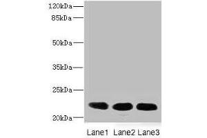 Western blot All lanes: CRIP2 antibody at 4. (CRIP2 Antikörper  (AA 1-208))