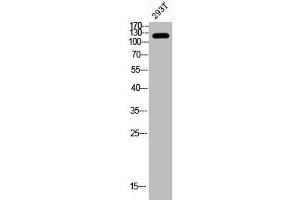 Western Blot analysis of 293T cells using Phospho-FAK (Y407) Polyclonal Antibody (FAK Antikörper  (pTyr407))