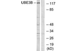 Western blot analysis of extracts from Jurkat cells, using UBE3B Antibody. (UBE3B Antikörper  (AA 581-630))