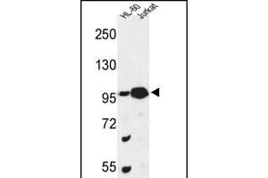 Western blot analysis of CS Antibody (N-term) (ABIN653334 and ABIN2842822) in HL-60, Jurkat cell line lysates (35 μg/lane). (CSPP1 Antikörper  (N-Term))