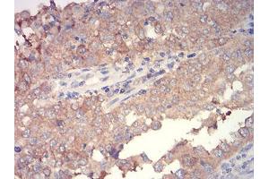 Immunohistochemistry (IHC) image for anti-Wingless-Type MMTV Integration Site Family, Member 3A (WNT3A) (AA 170-352) antibody (ABIN5906379) (WNT3A Antikörper  (AA 170-352))