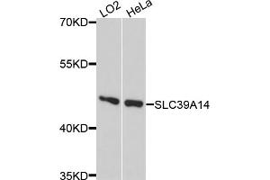 Western blot analysis of extracts of various cell lines, using SLC39A14 antibody. (SLC39A14 Antikörper)