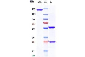 Anti-CXCR4 / CD184 Reference Antibody (ulocuplumab) on SDS-PAGE under reducing (R) condition. (Rekombinanter CXCR4 (Ulocuplumab Biosimilar) Antikörper)