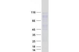 Validation with Western Blot