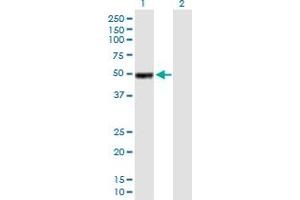 Western Blot analysis of IGHG1 expression in transfected 293T cell line by IGHG1 MaxPab polyclonal antibody. (IGHG1 Antikörper  (AA 1-469))