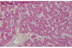 Human Liver: Formalin-Fixed, Paraffin-Embedded (FFPE) (GSTM1 Antikörper  (AA 1-159))