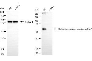 Western blotting analysis using collapsin response mediator protein 1 antibody (ABIN7798129). (Rekombinanter CRMP1 Antikörper)