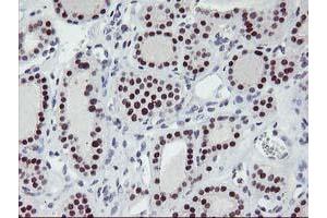 Image no. 2 for anti-Ankyrin Repeat Domain 53 (ANKRD53) (AA 1-300) antibody (ABIN1490719) (ANKRD53 Antikörper  (AA 1-300))