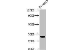 Western Blot Positive WB detected in: Rat stomach tissue All lanes: GCLM antibody at 3 μg/mL Secondary Goat polyclonal to rabbit IgG at 1/50000 dilution Predicted band size: 31, 29 kDa Observed band size: 31 kDa (GCLM Antikörper  (Regulatory Subunit))